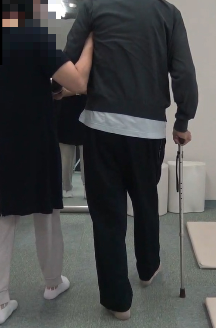 施術前の様子